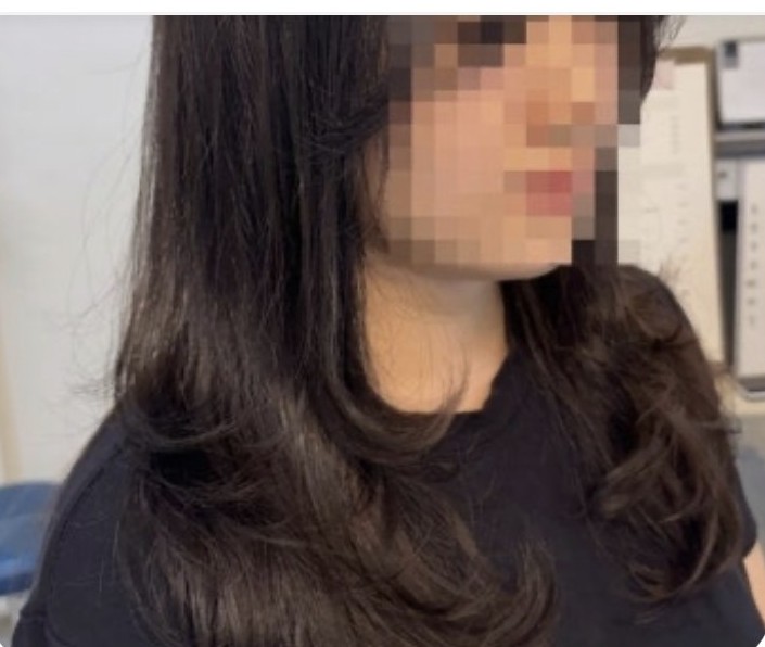 루멘45 펌 시술 후기 사진
